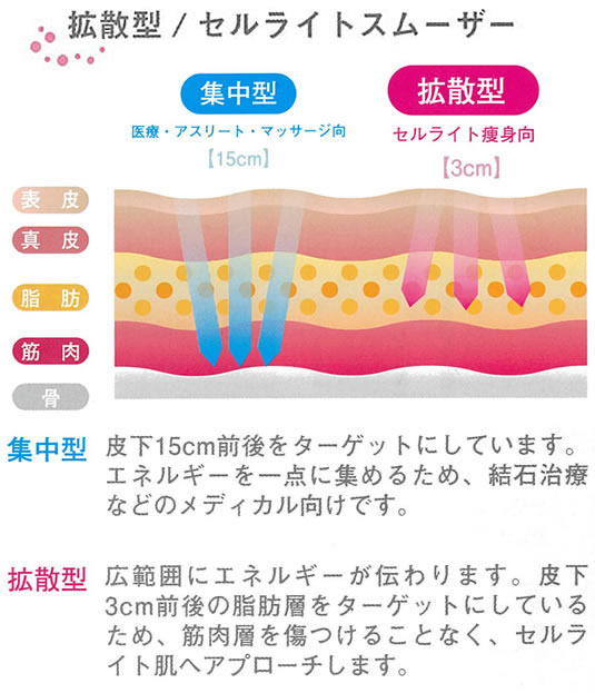 拡散型集中型セルライトスムーザー