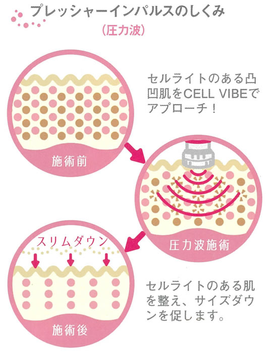 プレッシャーインパルスのしくみ